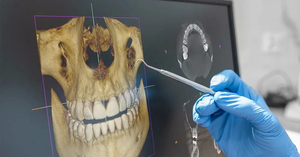 Profissional analisando uma tomografia odontológica em 3D